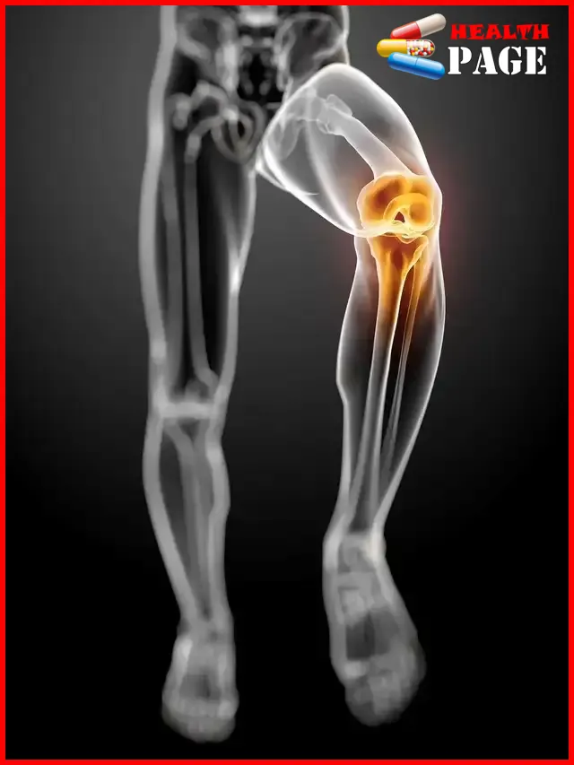 Orthopedic diseases
