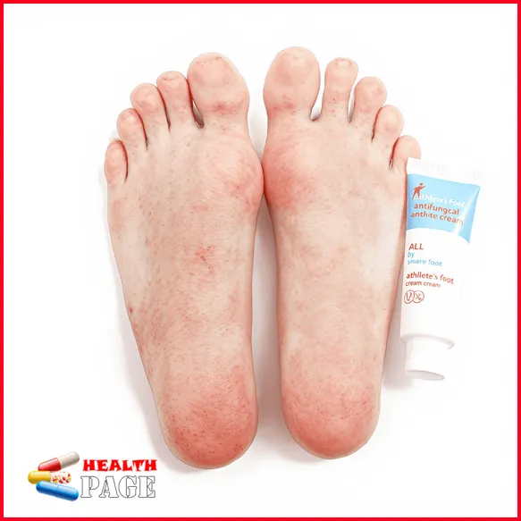 foot fungus cream