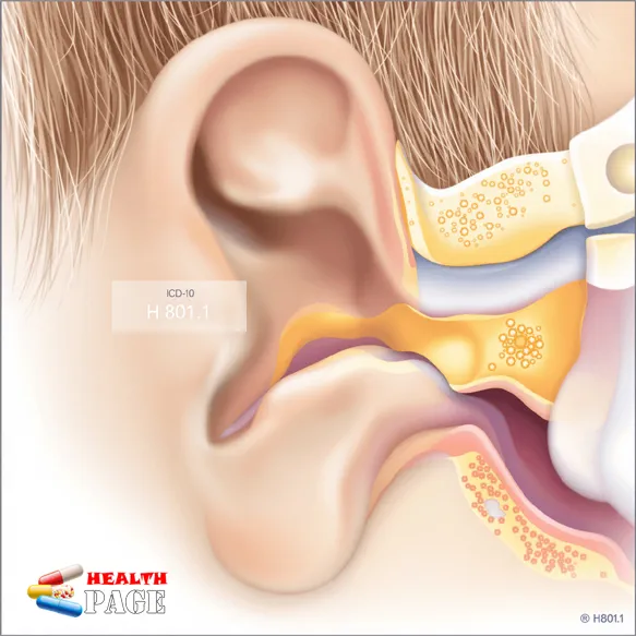 bpv icd 10