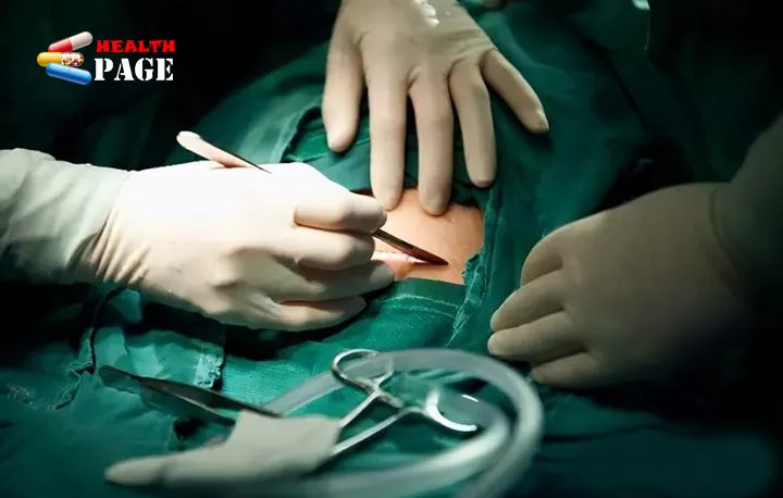 caesarean section