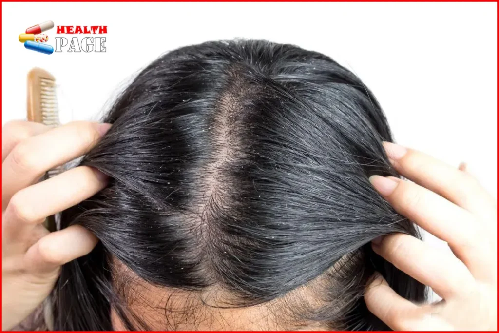 scalp health