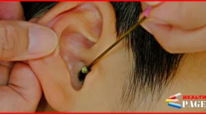 Earwax