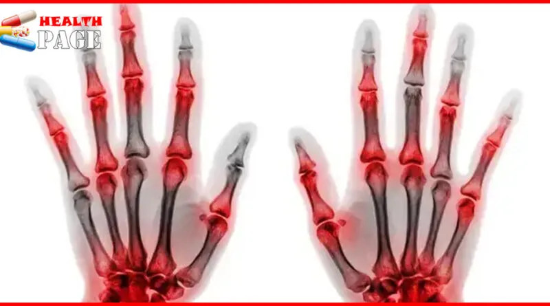 Orthopedic diseases