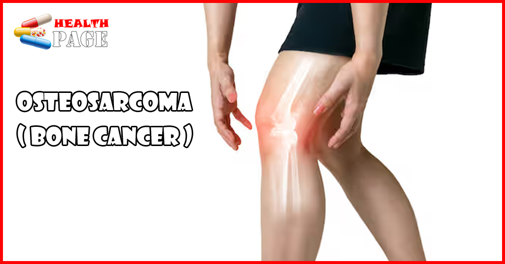 Osteosarcoma