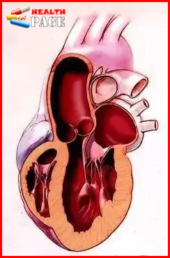 Normal myocardium