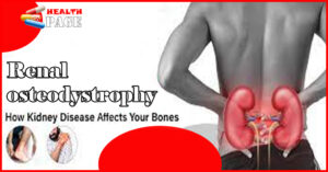 Renal osteodystrophy