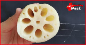 Lotus Root