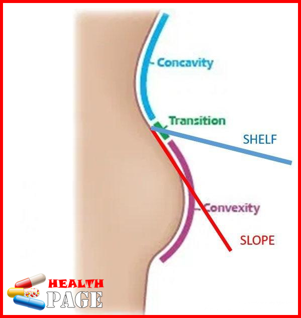 Brazilian Butt Lift procedure