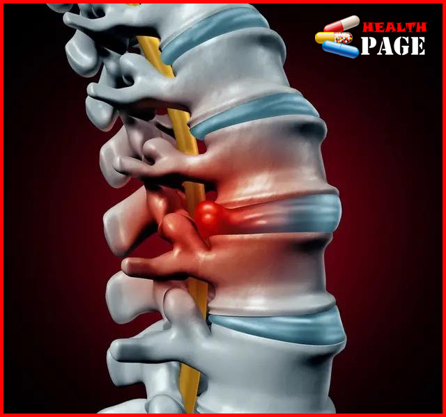 orthopedic diseases