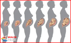 Gestational age