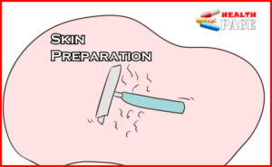 Skin preparation