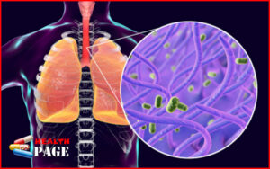 Whooping cough