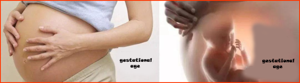 Gestational age