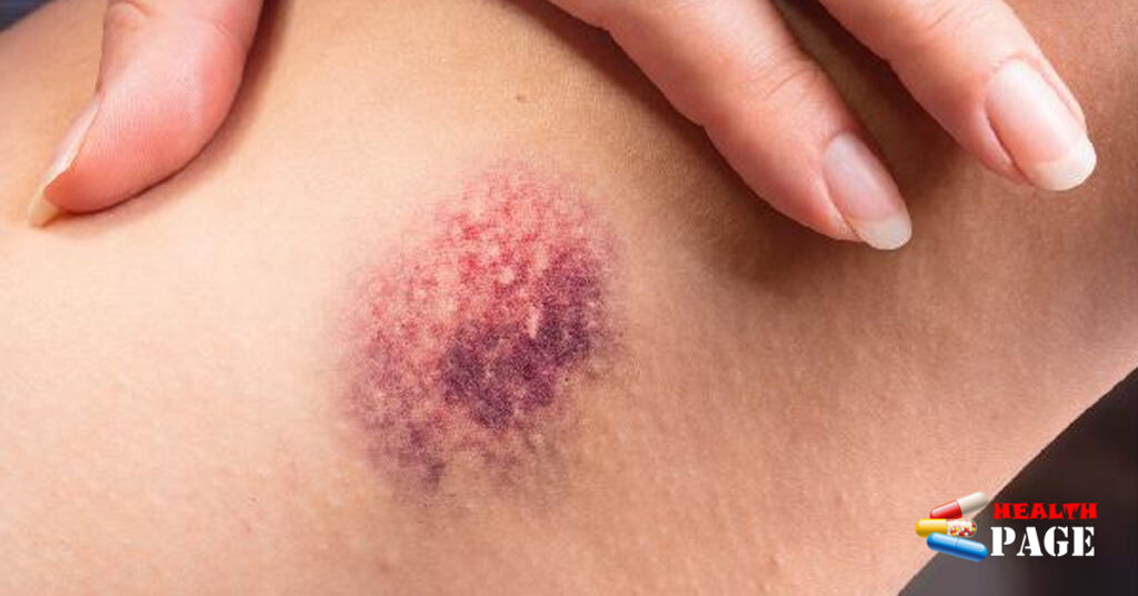 Red patches