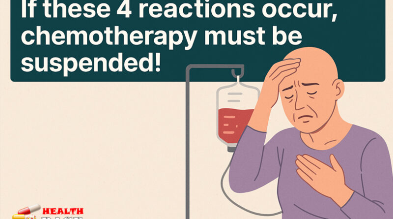 chemotherapy