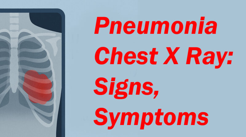 pneumonia chest x ray